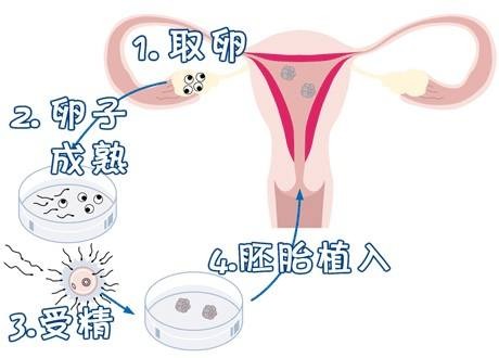 中国靠谱借卵代孕公司